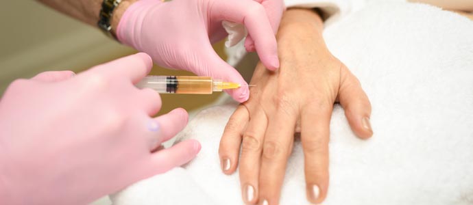 مراحل تزریق چربی به پشت دست
