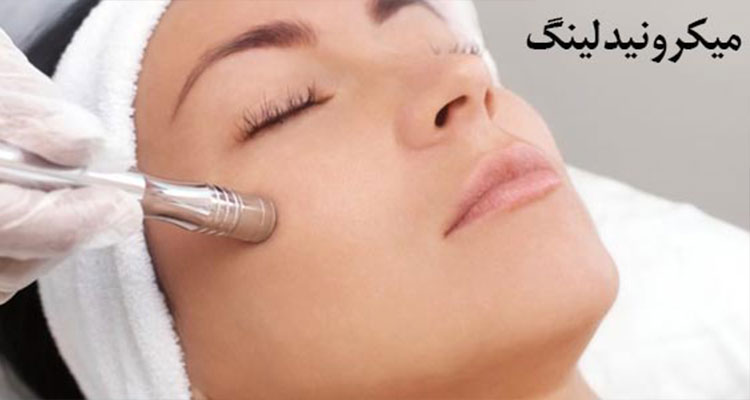 میکرونیدلینگ چیست؟ | همه چیز در مورد میکرونیدلینگ | مزایا و معایب میکرونیدلینگ