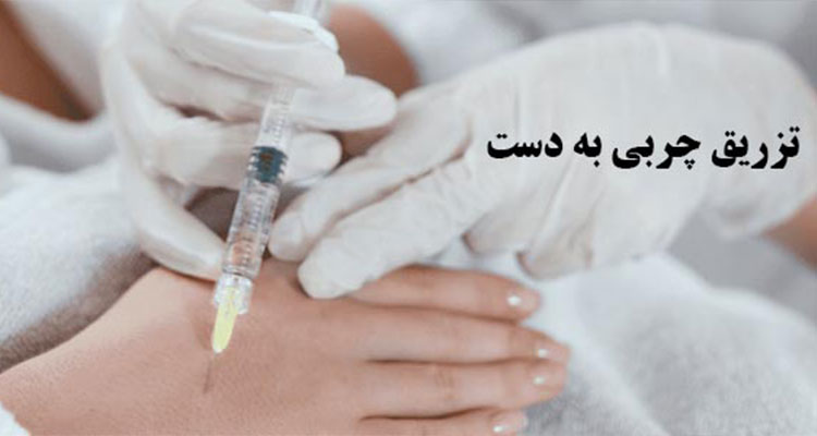 نکات مهم در مورد تزریق چربی به دست