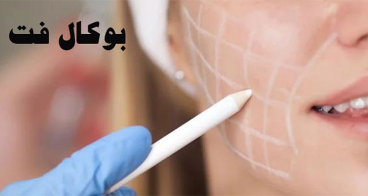 دانستنی های مهم درباره ی بوکال فت | لاغر کردن صورت | کوچک کردن لپ