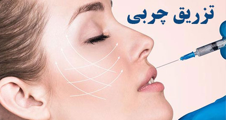 همه چیز درباره ی تزریق چربی